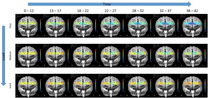 Determinen que el lòbul frontal és capaç de diferenciar diverses fases de la memòria de treball