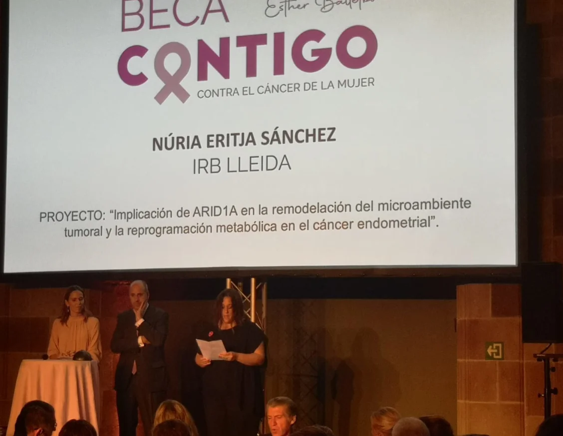 La ‘Fundación Contigo contra el cáncer de la mujer’ beca un projecte de Lleida per a identificar noves opcions terapèutiques per al càncer d'úter