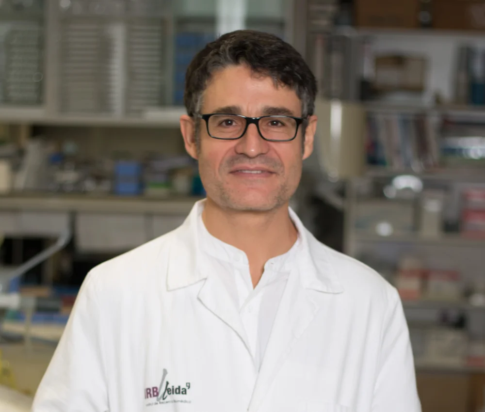 Identifican una proteína como elemento fundamental en el desarrollo del cerebro