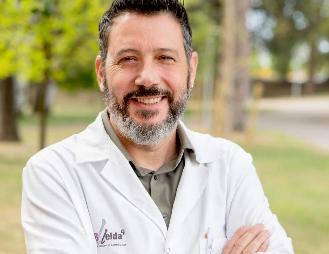Financian un proyecto europeo con participación del IRBLleida para estudiar el envejecimiento vascular prematuro en enfermedad renal crónica y diabetes tipo 2