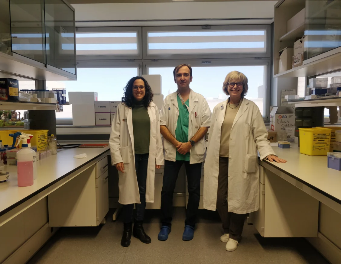 Una recerca liderada des de Lleida identifica un potencial biomarcador del comportament dels melanomes