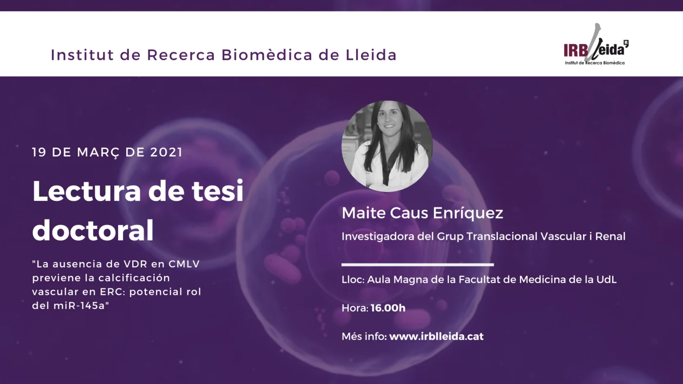 Doctoral thesis reading - Staff #IRBLleida