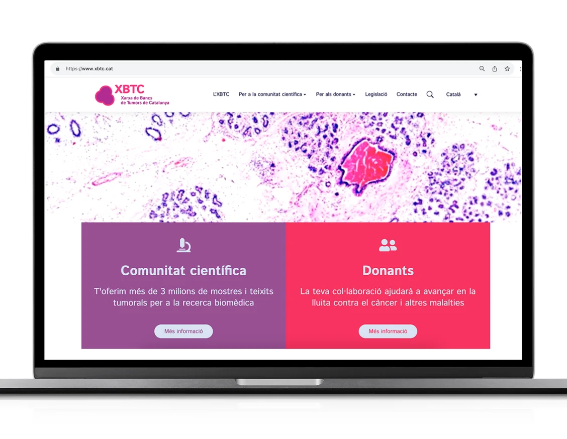 La Xarxa de Bancs de Tumors de Catalunya estrena nova identitat corporativa i web